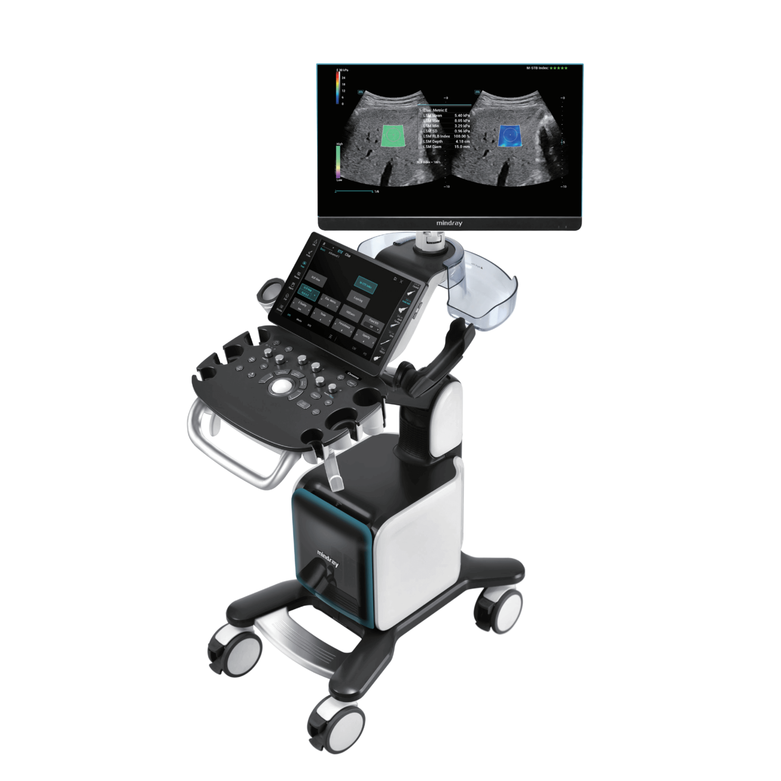 УЗИ аппарат Consona N9 Mindray